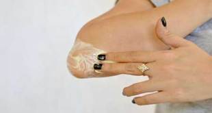 কালো ও শক্ত কনুই