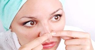 ব্ল্যাকহেডস সমস্যা